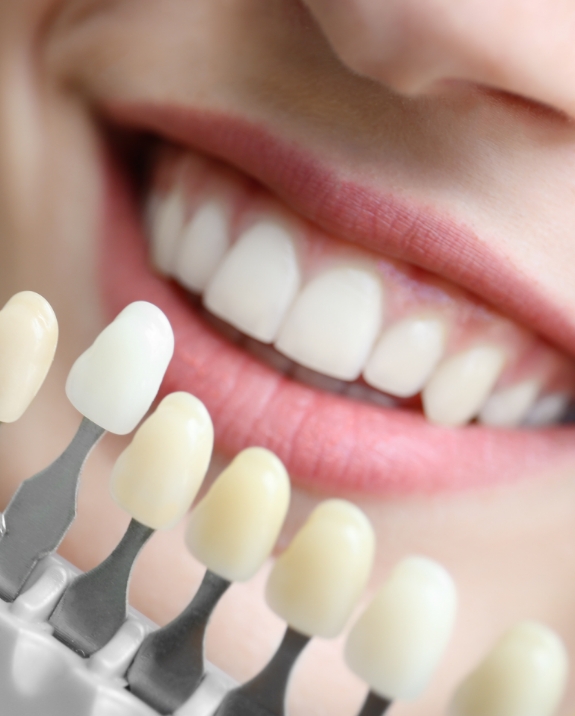 Cosmetic dentist holding shade guide next to a smile