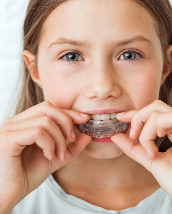 Girl placing a clear nightguard over her teeth