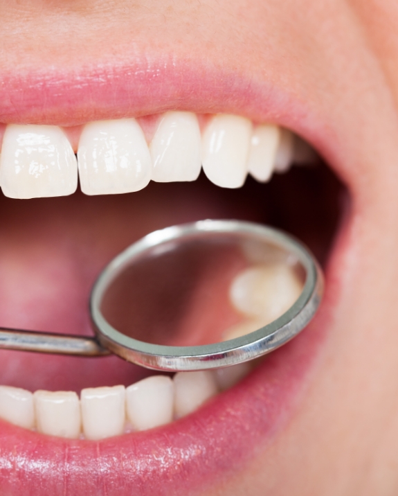 Close up of dental mirror inside of mouth